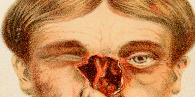 ¿Donar el cuerpo a la ciencia? 5 cosas que quizá NO quieras saber