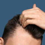 Por qué se cae el pelo