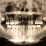 ¿Destruye la Cola-Cola los dientes?