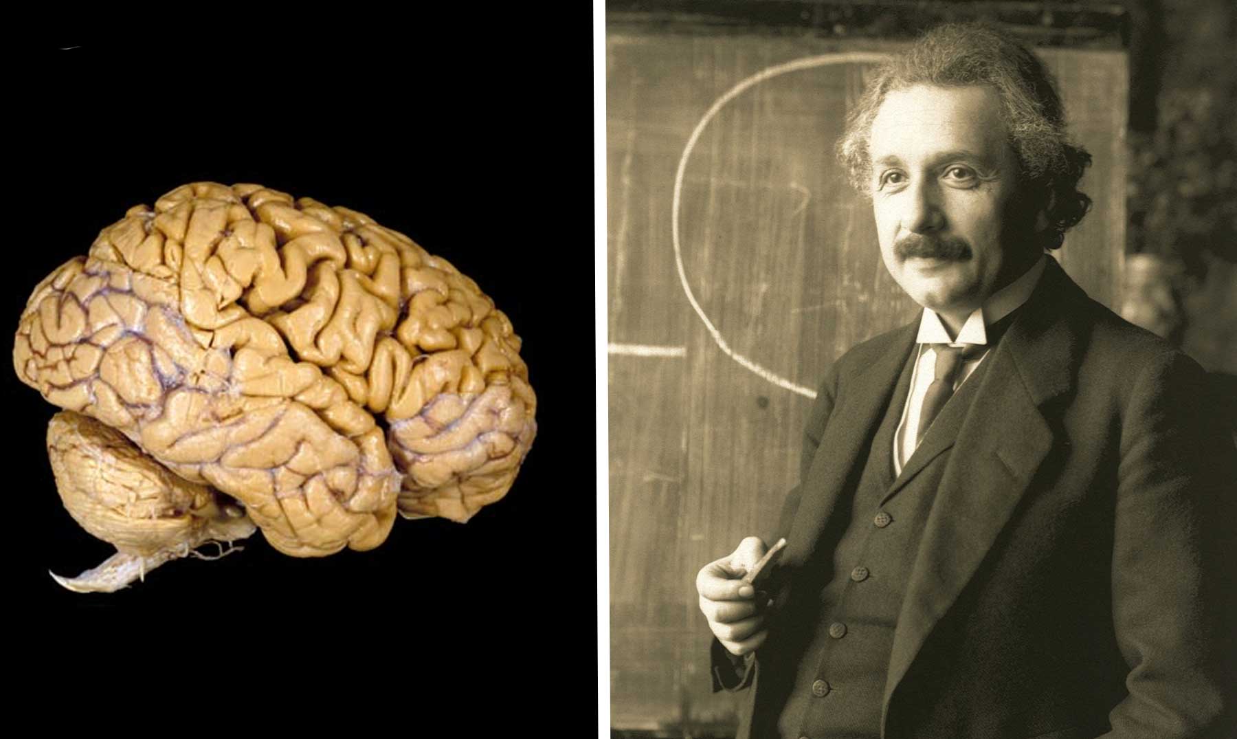 El curioso cerebro de Albert Einstein