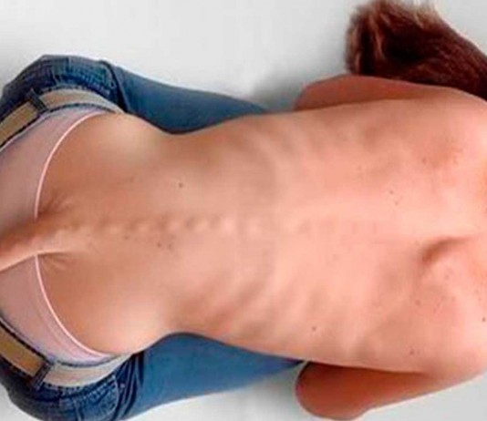 Cola vestigial humana