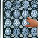 curiosidades del cerebro