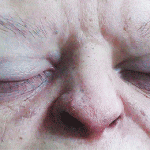 ojos fase rem