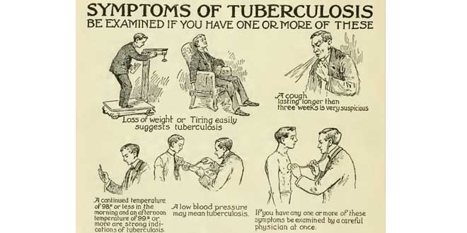Ilustración de Julio de 1918 que describe los síntomas de la tuberculosis, Boletín de Salud de Carolina del Norte,