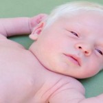 Curiosidades sobre el albinismo