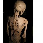 Esqueleto de un afectado por la Fibrodysplasia-ossificans
