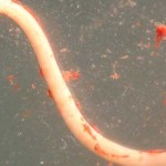 anisakis