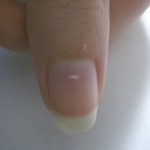 ¿Qué son los puntos blancos en mis uñas?