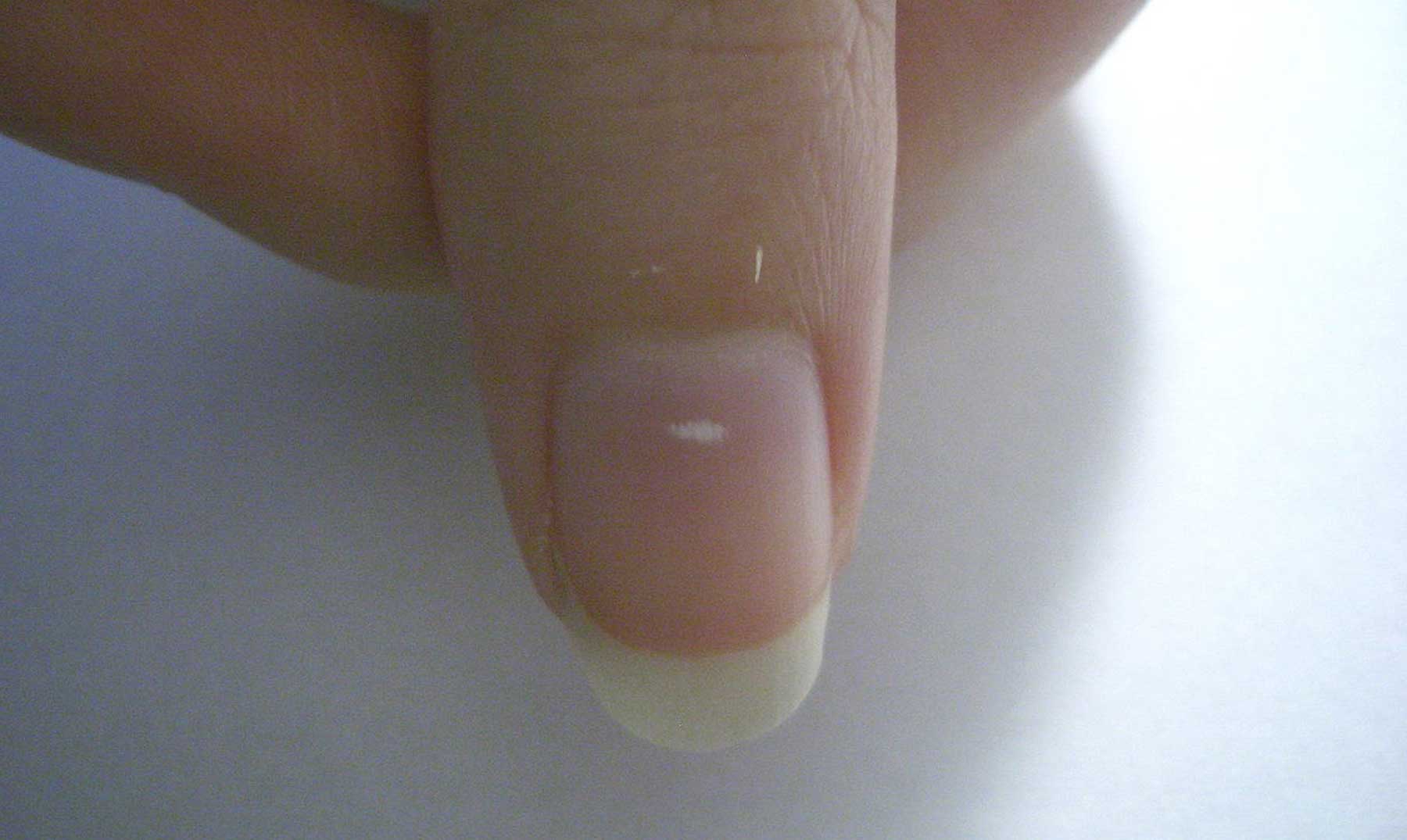 ¿Qué son los puntos blancos en mis uñas?