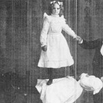 Rigidez de la catalepsia