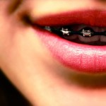 Brackets: 8 mitos y curiosidades