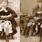 Myrtle Corbin, la chica con cuatro piernas de Texas