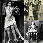 Myrtle Corbin, la chica con cuatro piernas de Texas