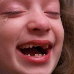 ¿Por qué nos duele tanto golpearnos el codo?
