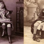 Myrtle Corbin, la chica con cuatro piernas de Texas