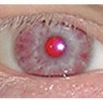 ojos rojos