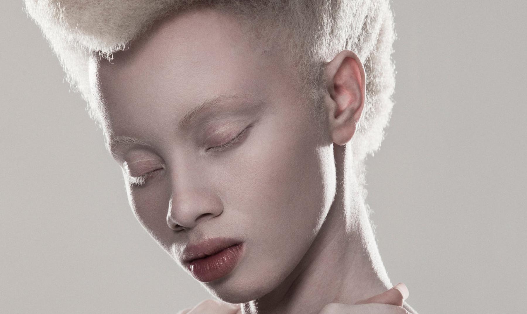 Thando Hopa | Primera modelo albina y activista sudafricana