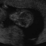 Hipo: respuestas y 10 curiosidades