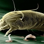 Los arácnidos que habitan tu cuerpo