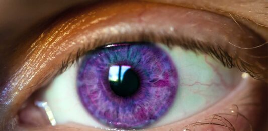 que es el sindrome de alejandria ojos de color morado