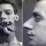 Las 3 primeras e impactantes operaciones de cirugía estética