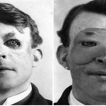 Las 3 primeras e impactantes operaciones de cirugía estética