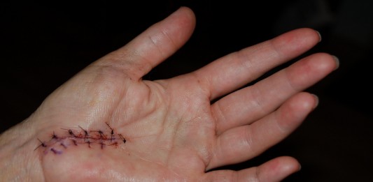 5 BENEFICIOS que no conocías del aguacate