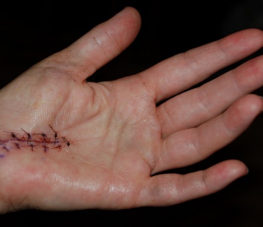 5 BENEFICIOS que no conocías del aguacate