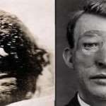 Las 3 primeras e impactantes operaciones de cirugía estética