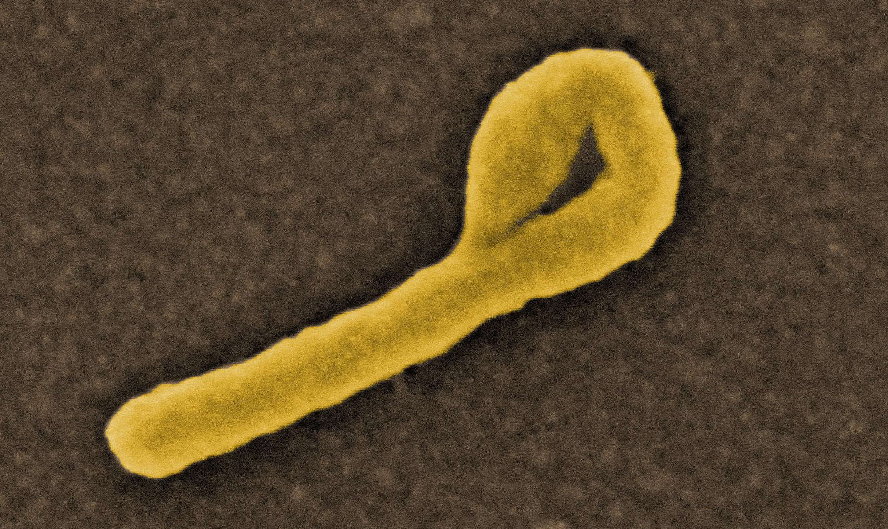 ¿Qué impacto tendría una crisis global de ébola sobre la seguridad sanitaria mundial?
