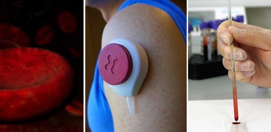 ¿Un análisis de sangre sin necesidad de aguja? ¡Sí, ya es posible! Extracción de sangre sin agujas