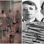 Las 3 primeras e impactantes operaciones de cirugía plástica