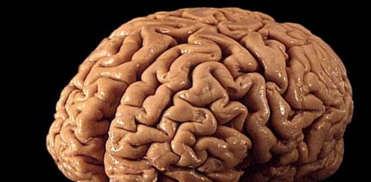 ¿Sabes qué es la reserva cognitiva?