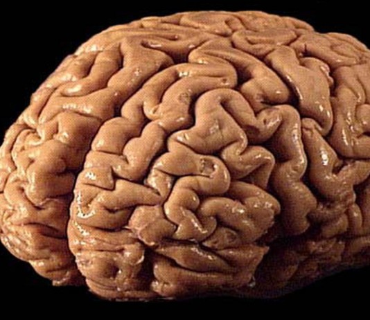 ¿Sabes qué es la reserva cognitiva?