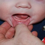 Bebés que nacen con dientes, algo terrible para muchas culturas