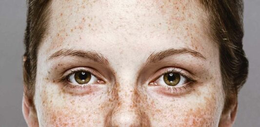 9 Curiosidades de las pecas | ¡Datos que te sorprenderán! curiosidades de las pecas