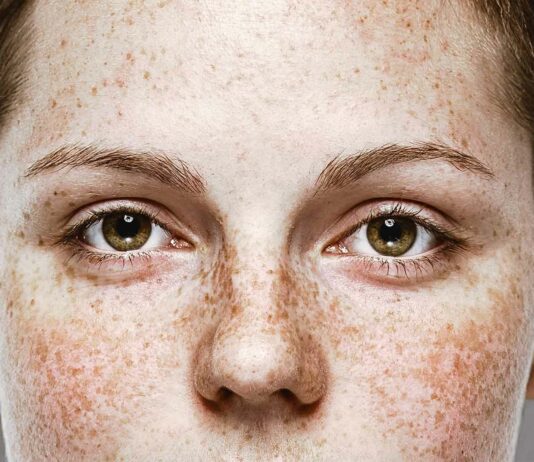 curiosidades de las pecas