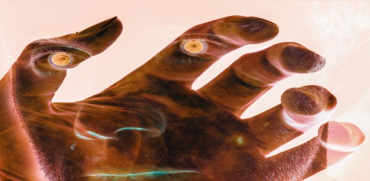 El inquietante "síndrome de la mano alienígena"