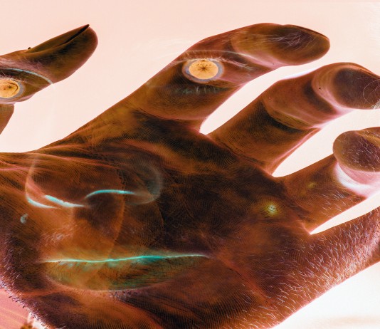 El inquietante "síndrome de la mano alienígena"