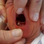 Bebés que nacen con dientes, algo terrible para muchas culturas