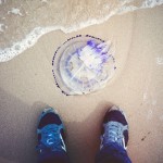 Orinar en una picadura de medusa. ¿Funciona?
