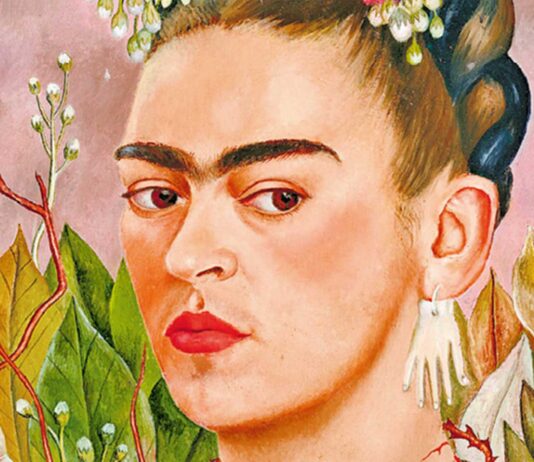 enfermedad de frida kahlo