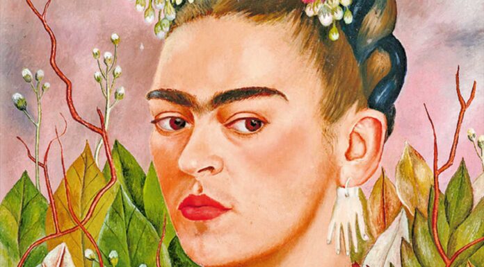 enfermedad de frida kahlo