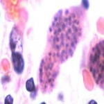gato, toxoplasmosis