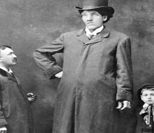 triste historia de Édouard Beaupré, el gigante de corazón tranquilo