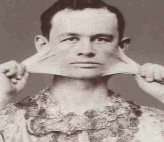 James Morris, el fantástico «hombre de goma» James Morris, el fantástico "hombre de goma"