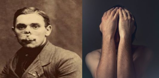 La historia de los hombres sin rostro de la Primera Guerra Mundial