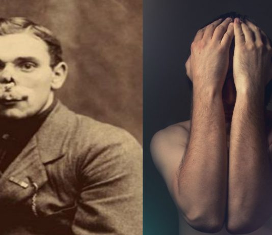 La historia de los hombres sin rostro de la Primera Guerra Mundial