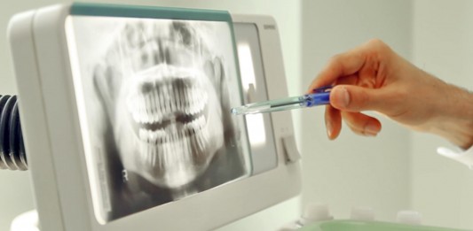 ¿Eres de los que rechinan los dientes por la noche? ¿Eres de los que rechinan los dientes por la noche?