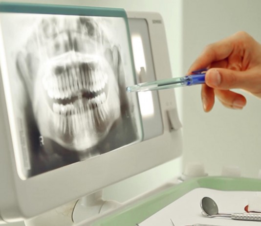¿Eres de los que rechinan los dientes por la noche? ¿Eres de los que rechinan los dientes por la noche?